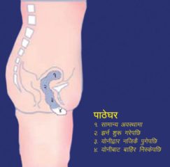 आङ खस्ने प्रकोप
